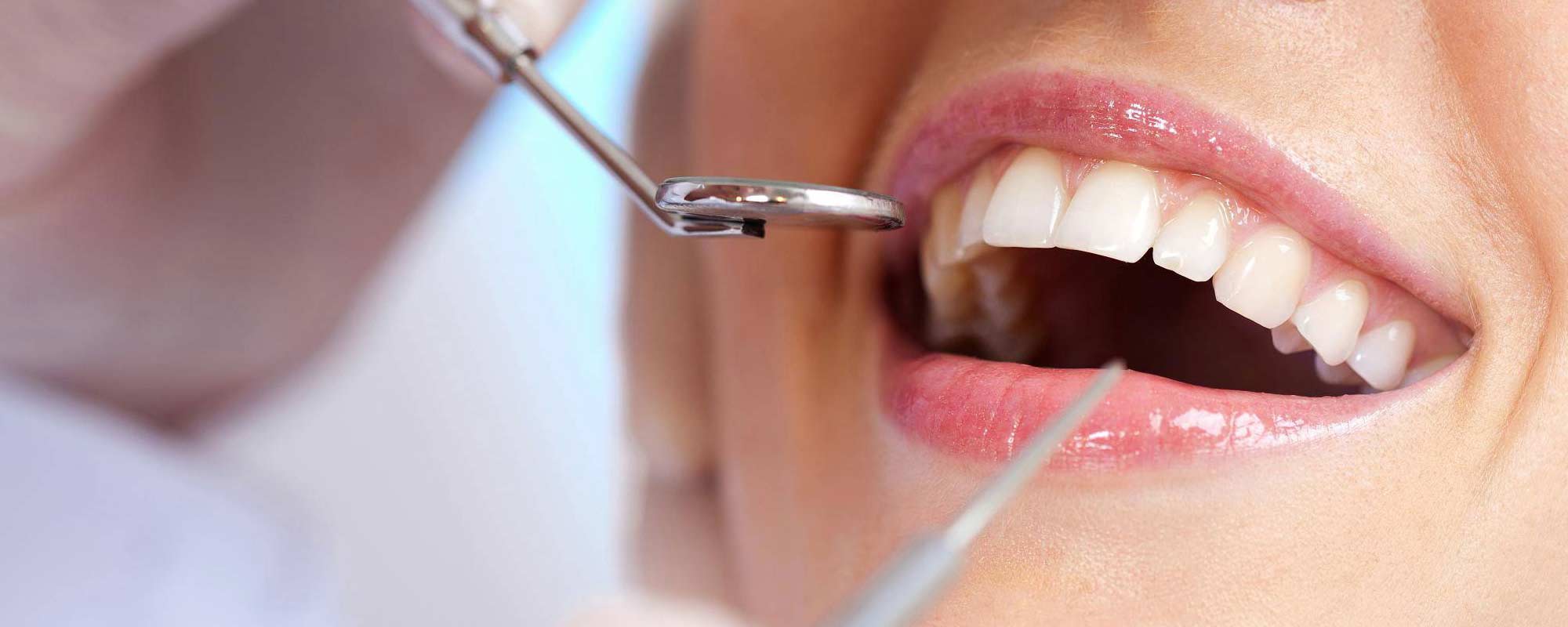 Zubni Implanti