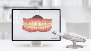 Digitalna stomatologija - Upotreba skenera